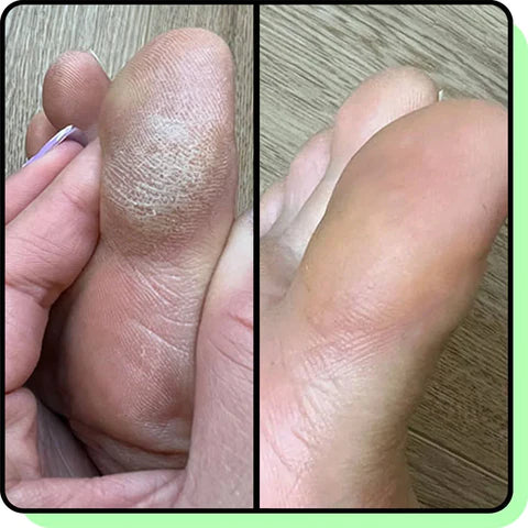 Pedicure 3.0 Professionale - Piedi perfetti a casa!