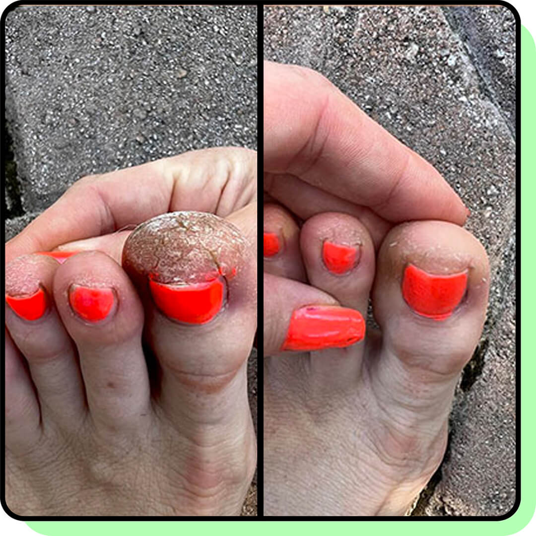 Pedicure 3.0 Elettrico Professionale - Piedi Perfetti in 7 minuti