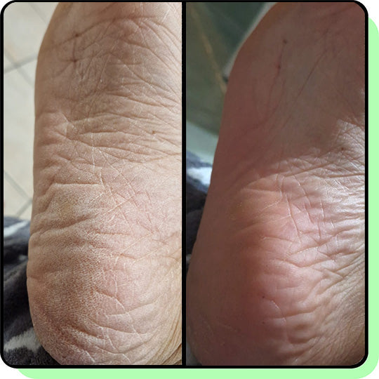 Pedicure 3.0 Professionale - Piedi perfetti a casa